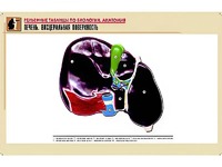 Рельефная таблица "Печень. Висцеральная поверхность" (формат А1, матовое ламинирование) - fgospostavki.ru - Одинцово