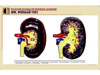 Рельефная таблица "Почка. Фронтальный разрез" (формат А1, матовое ламинирование) - fgospostavki.ru - Одинцово